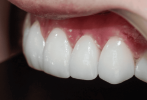 Captura de pantalla 2025-04-25 070658